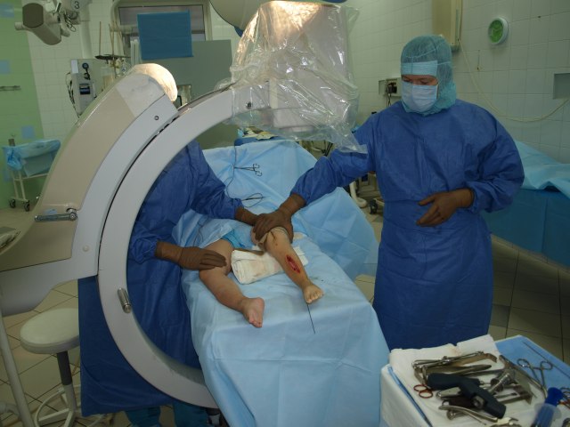 Čuveni ruski ortoped za B92: Ilizarov metod skup, ali menja život dece